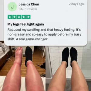 100K+ SOLD 🔥 Healrize® Professional Leg Circulation Cream