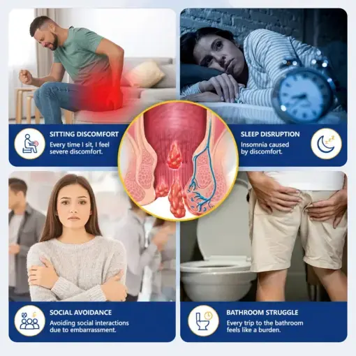 Healrize® ComfortShield Hemorrhoid Relief Ointment