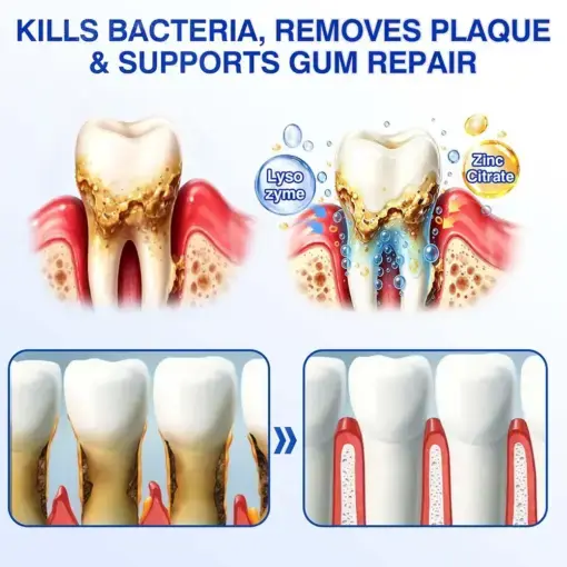 Healrize® GumRevive gel