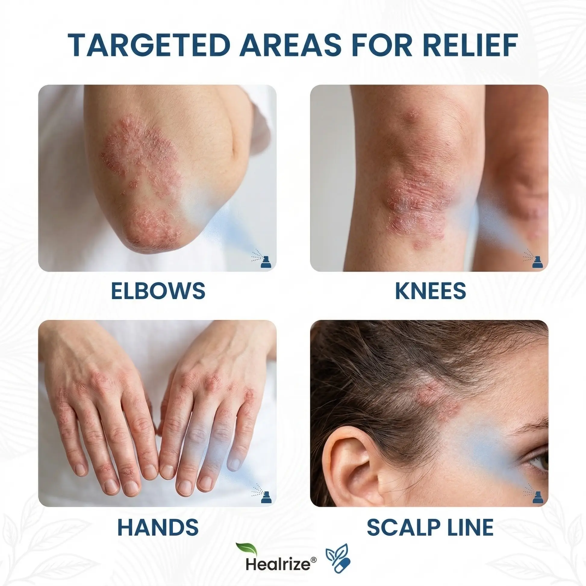 Healrize® Magnesium Spray