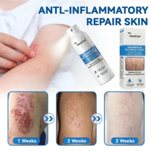 Healrize® Magnesium Spray