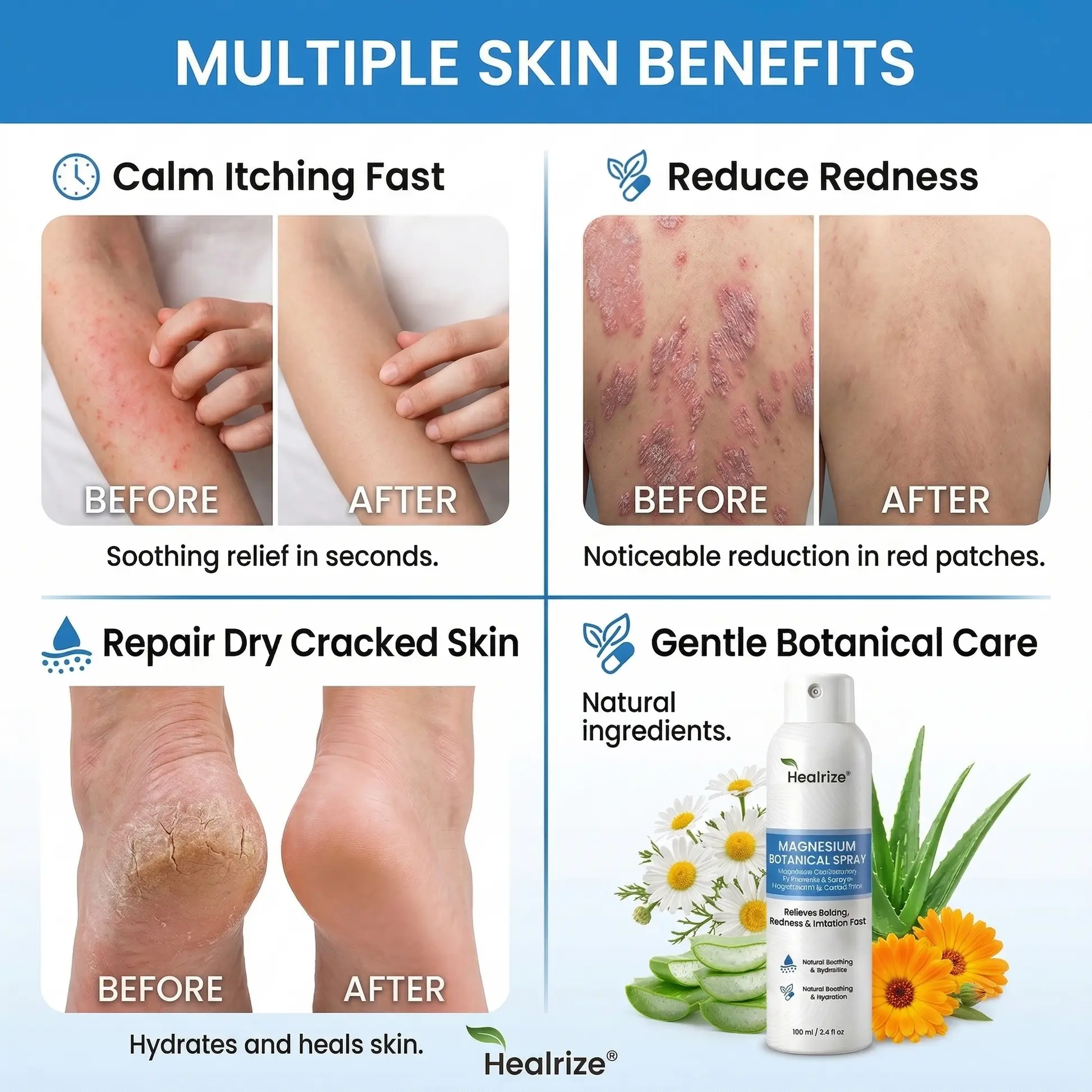 Healrize® Magnesium Spray