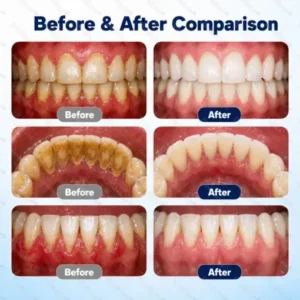 Healrize® Oral Repair Liquid