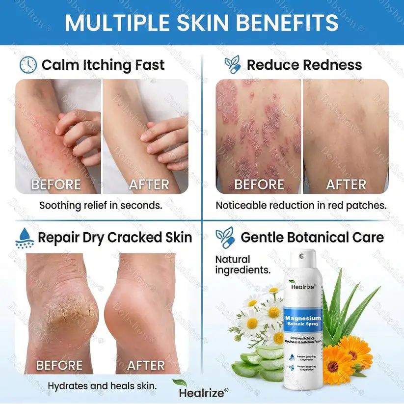 OFFICIAL
BRAND
Healrize® Magnesium Botanic Spray – Advanced Skin Recovery for Psoriasis & Eczema | Rapid Soothing, Steroid-Free