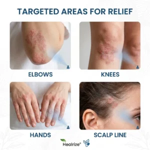 OFFICIAL
BRAND
Healrize® Magnesium Botanic Spray – Advanced Skin Recovery for Psoriasis & Eczema | Rapid Soothing, Steroid-Free