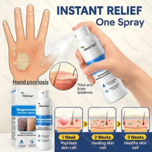 OFFICIAL
BRAND
Healrize® Magnesium Botanic Spray – Advanced Skin Recovery for Psoriasis & Eczema | Rapid Soothing, Steroid-Free