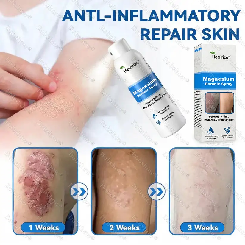OFFICIAL
BRAND
Healrize® Magnesium Botanic Spray – Advanced Skin Recovery for Psoriasis & Eczema | Rapid Soothing, Steroid-Free