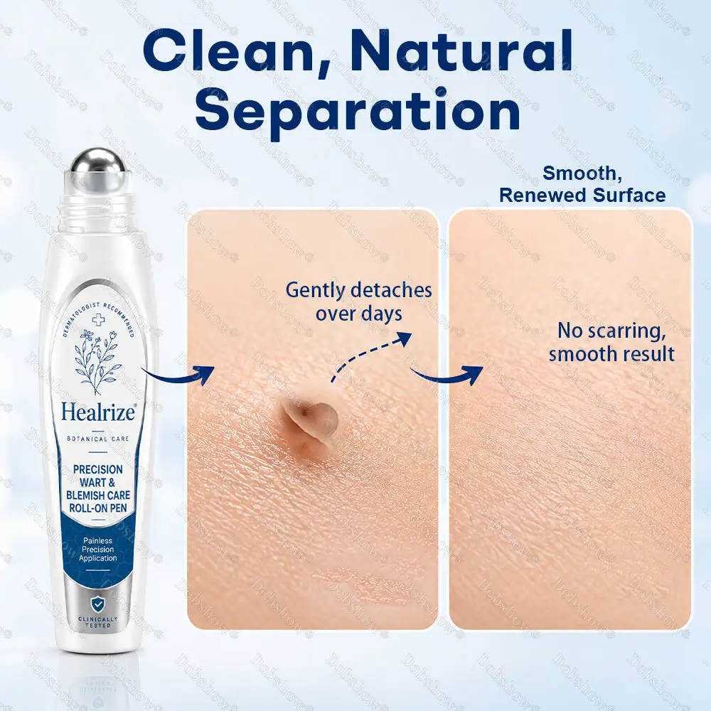 OFFICIAL
BRAND
Healrize® Precision Wart & Blemish Care Roll-On Pen